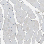 Immunohistochemical staining of human skeletal muscle shows no positivity in myocytes as expected.