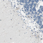 Immunohistochemical staining of human cerebellum shows no positivity in Purkinje cells as expected.