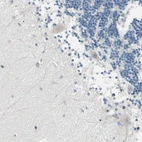 Immunohistochemical staining of human cerebellum shows no positivity in Purkinje cells as expected.