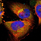 Immunofluorescent staining of human cell line U-251 MG shows localization to cytosol & the Golgi apparatus.