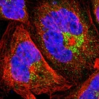 Immunofluorescent staining of human cell line A-431 shows localization to the Golgi apparatus & vesicles.