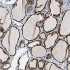 Anti-RETSAT Antibody