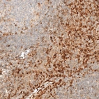 Anti-VSIR Antibody