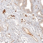 Immunohistochemical staining of human Fallopian tube shows strong cytoplasmic positivity in leukocytes.