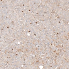 Immunohistochemical staining of human liver shows strong cytoplasmic positivity in leukocytes.