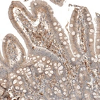 Immunohistochemical staining of human small intestine shows moderate cytoplasmic positivity in lymphoid cells.