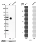 Western blot analysis in human cell lines A-431 and HEK293 using Anti-VSIR antibody. Corresponding VSIR RNA-seq data are presented for the same cell lines. Loading control: Anti-GAPDH.