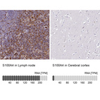 Anti-S100A4 Antibody