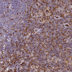 Immunohistochemical staining of human lymph node shows strong cytoplasmic positivity in non-germinal center cells.