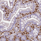 Anti-S100A4 Antibody