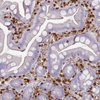 Immunohistochemical staining of human small intestine shows strong cytoplasmic positivity in lymphoid cells.