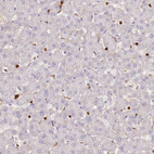 Immunohistochemical staining of human liver shows no positivity in hepatocytes as expected.