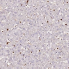 Immunohistochemical staining of human liver shows no positivity in hepatocytes as expected.