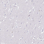 Immunohistochemical staining of human cerebral cortex shows no positivity in neurons as expected.