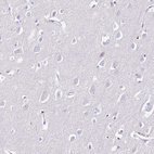 Anti-S100A4 Antibody