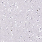 Immunohistochemical staining of human cerebral cortex shows no positivity in neurons as expected.