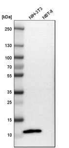 Anti-S100A4 Antibody