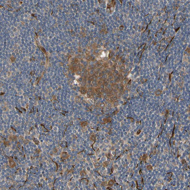 Anti-FGD6 Antibody