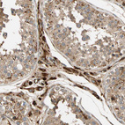 Immunohistochemical staining of human testis shows strong cytoplasmic positivity in Leydig cells.