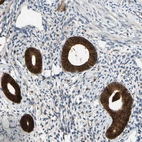 Immunohistochemical staining of human endometrium shows strong cytoplasmic positivity in glandular cells.