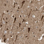 Immunohistochemical staining of human cerebral cortex shows strong cytoplasmic positivity in neurons.