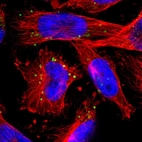 Immunofluorescent staining of human cell line U-251 MG shows localization to vesicles.