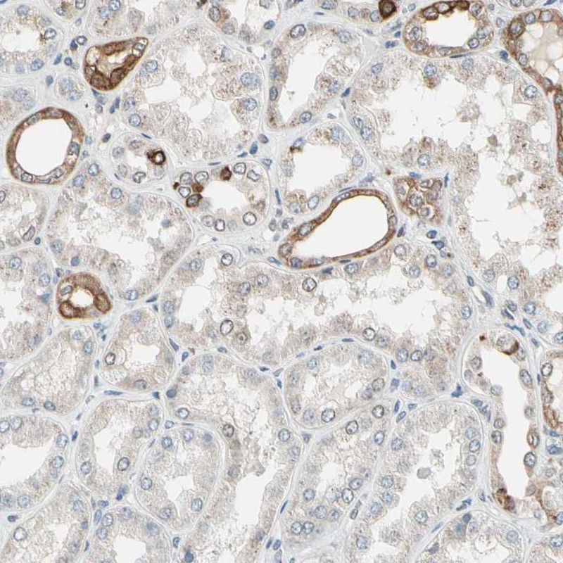 Anti-PTH1R Antibody