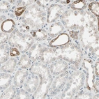 Anti-PTH1R Antibody