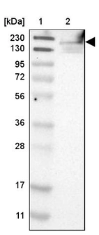 Lane 1: Marker [kDa] 230, 130, 95, 72, 56, 36, 28, 17, 11_br/_Lane 2: Human cell line RT-4