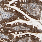 Immunohistochemical staining of human small intestine shows high expression.