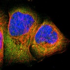 Immunofluorescent staining of human cell line A-431 shows localization to cytosol.