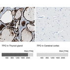 Anti-TPO Antibody