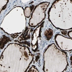 Immunohistochemical staining of human thyroid gland shows high expression.