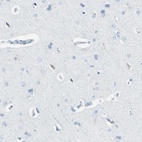 Anti-TPO Antibody