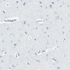 Immunohistochemical staining of human cerebral cortex shows low expression as expected.