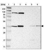 Lane 1: Marker [kDa] 230, 130, 95, 72, 56, 36, 28, 17, 11_br/_Lane 2: Human cell line RT-4_br/_Lane 3: Human cell line U-251MG sp_br/_Lane 4: Human plasma (IgG/HSA depleted)_br/_Lane 5: Human liver tissue_br/_Lane 6: Human tonsil tissue