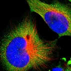 Immunofluorescent staining of human cell line U-251 MG shows localization to cytosol.