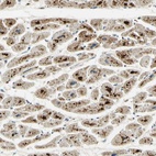 Anti-ARHGEF17 Antibody