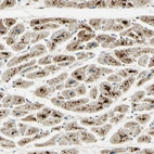 Anti-ARHGEF17 Antibody