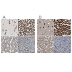 Immunohistochemical staining of human cerebral cortex, heart muscle, liver and pancreas using Anti-UQCRC2 antibody HPA007998 (A) shows similar protein distribution across tissues to independent antibody HPA019146 (B).