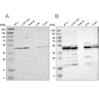 Western blot analysis using Anti-UQCRC2 antibody HPA007998 (A) shows similar pattern to independent antibody HPA019146 (B).