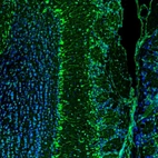 Immunofluorescence staining of mouse brain shows positivity in neurons in the olfactory bulb.