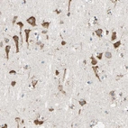 Immunohistochemical staining of human cerebral cortex shows strong cytoplasmic positivity in neurons.