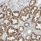 Immunohistochemical staining of human kidney shows strong cytoplasmic positivity in cells in tubules.