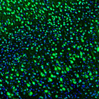 Immunofluorescence staining of mouse somatosensory cortex shows positivity in neurons.