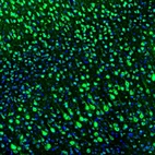 Immunofluorescence staining of mouse somatosensory cortex shows positivity in neurons.