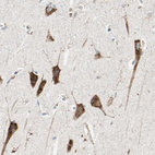 Immunohistochemical staining of human hippocampus shows moderate cytoplasmic positivity in neuronal cells.