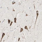 Immunohistochemical staining of human hippocampus shows moderate cytoplasmic positivity in neuronal cells.
