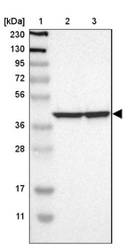 Lane 1: Marker [kDa] 230, 130, 95, 72, 56, 36, 28, 17, 11_br/_Lane 2: Human cell line RT-4_br/_Lane 3: Human cell line U-251MG sp