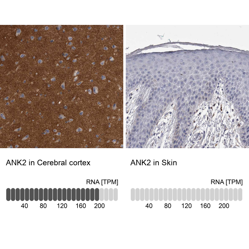 Anti-ANK2 Antibody